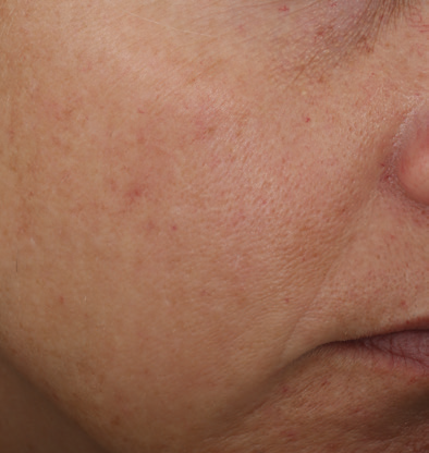 even correct serum 1 week 8
