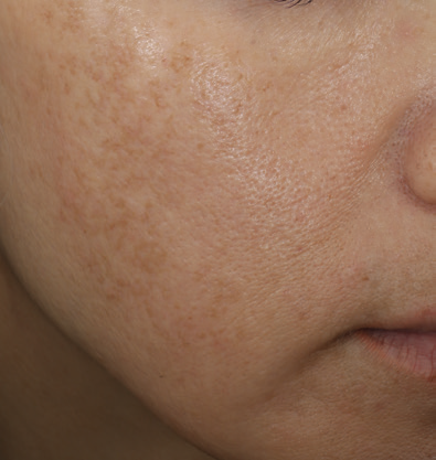 even correct serum 2 baseline