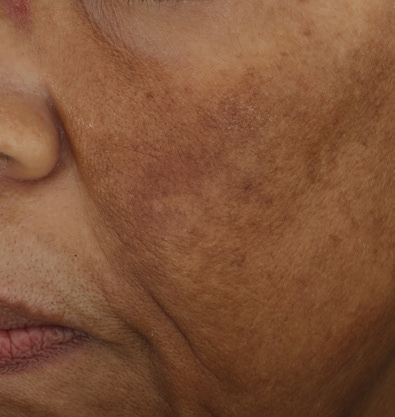 even correct serum 3 baseline