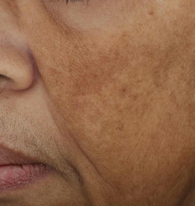 even correct serum 3 week 12