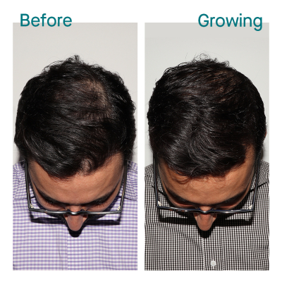 1601326725 Before Growing Aman 10 months