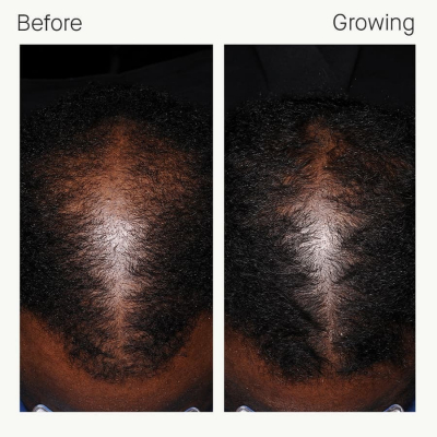 1602101152 Before Growing Eric 6 months