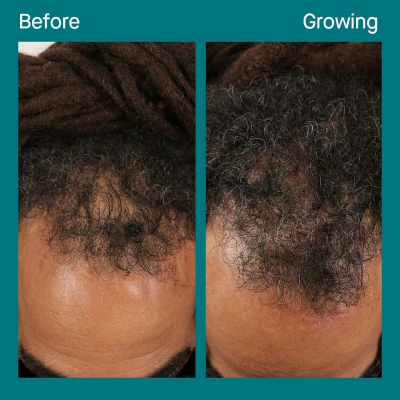 1602101248 Before Growing Kyron 4 months