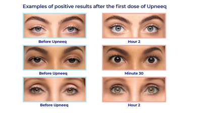 upneeq examples 1